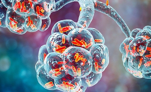 بیماری پریون و نحوه ی استریل ابزارهای آلوده به این عفونت، استریلیزاسیون